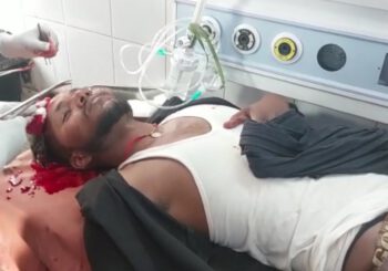 जीजा ने अपने साले पर किया चाकू से हमला, साला गंभीर रूप से घायल